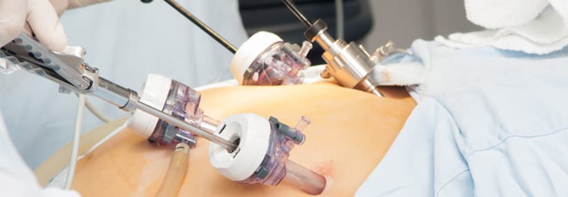 Top-Erfahrungen internationaler Patienten zur Magen Op Türkei