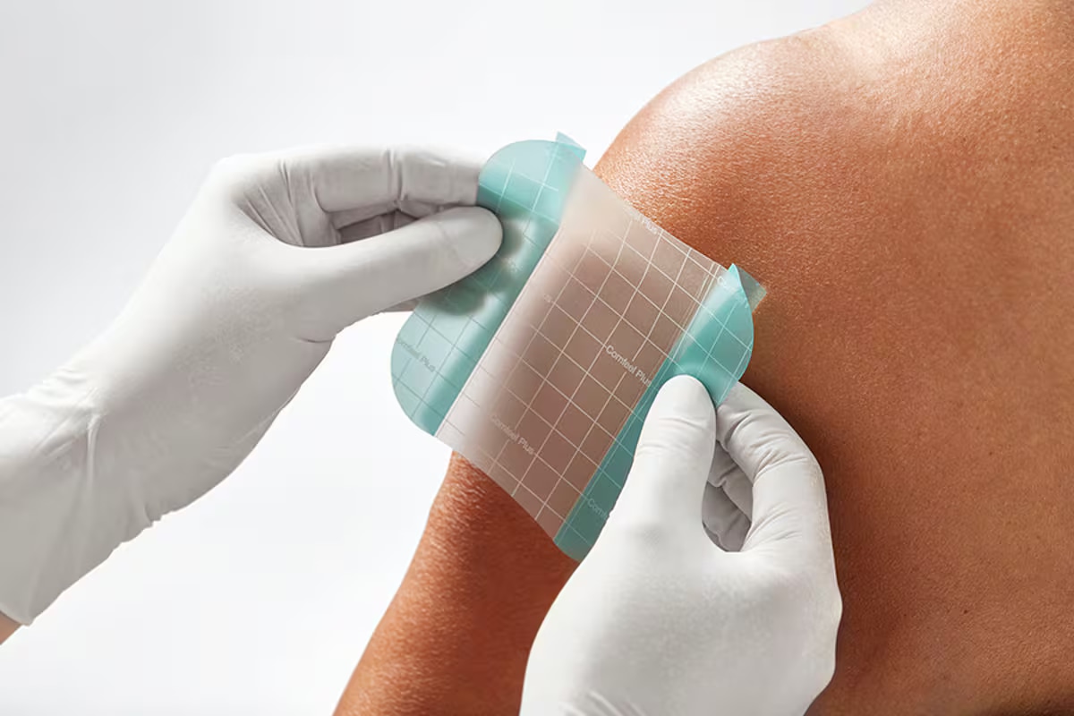 hydrocoll wundverband