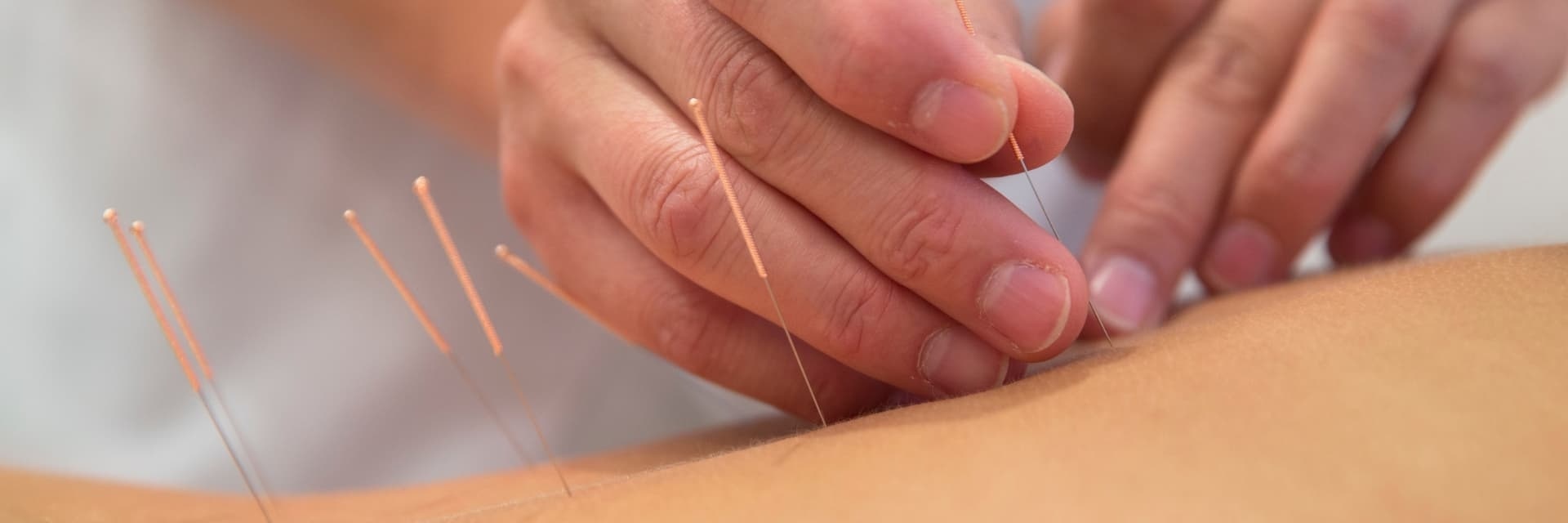 Akupunktura és az egészséges életmód – Akupunkturbehandlungen usw