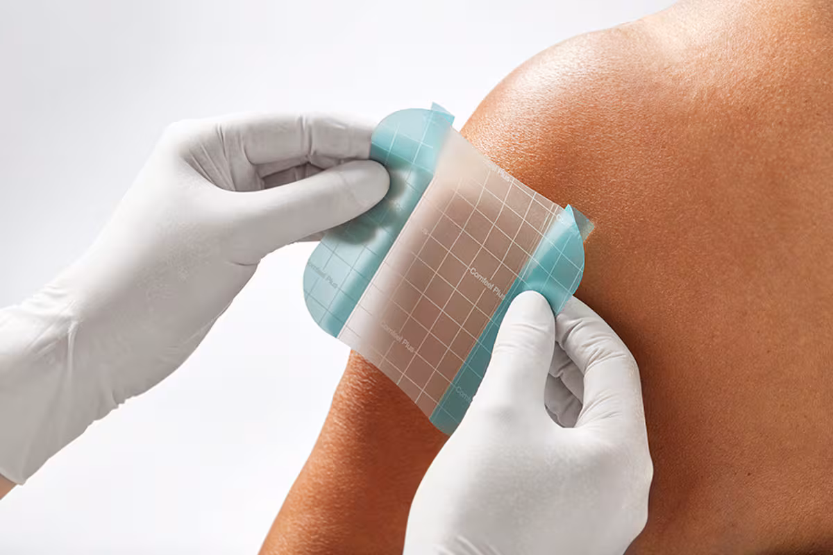 hydrocoll wundverband